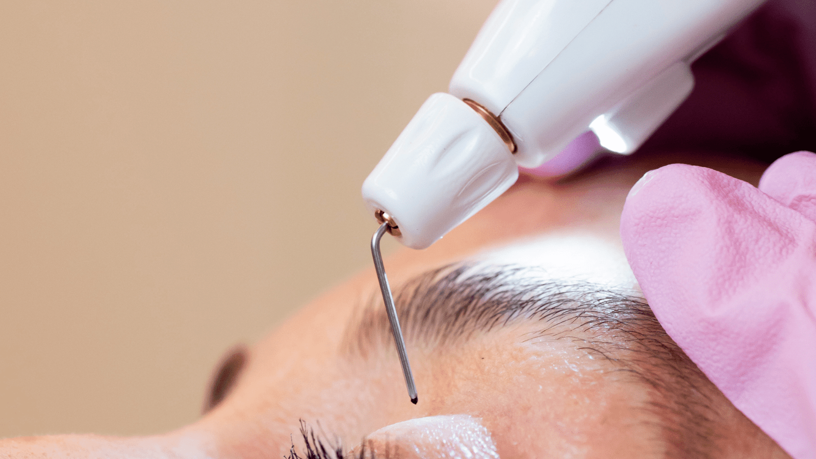 ¡Claro! Aquí tienes un título para tu artículo: Todo lo que necesitas saber sobre el Plasma Pen: Guía de uso y beneficios