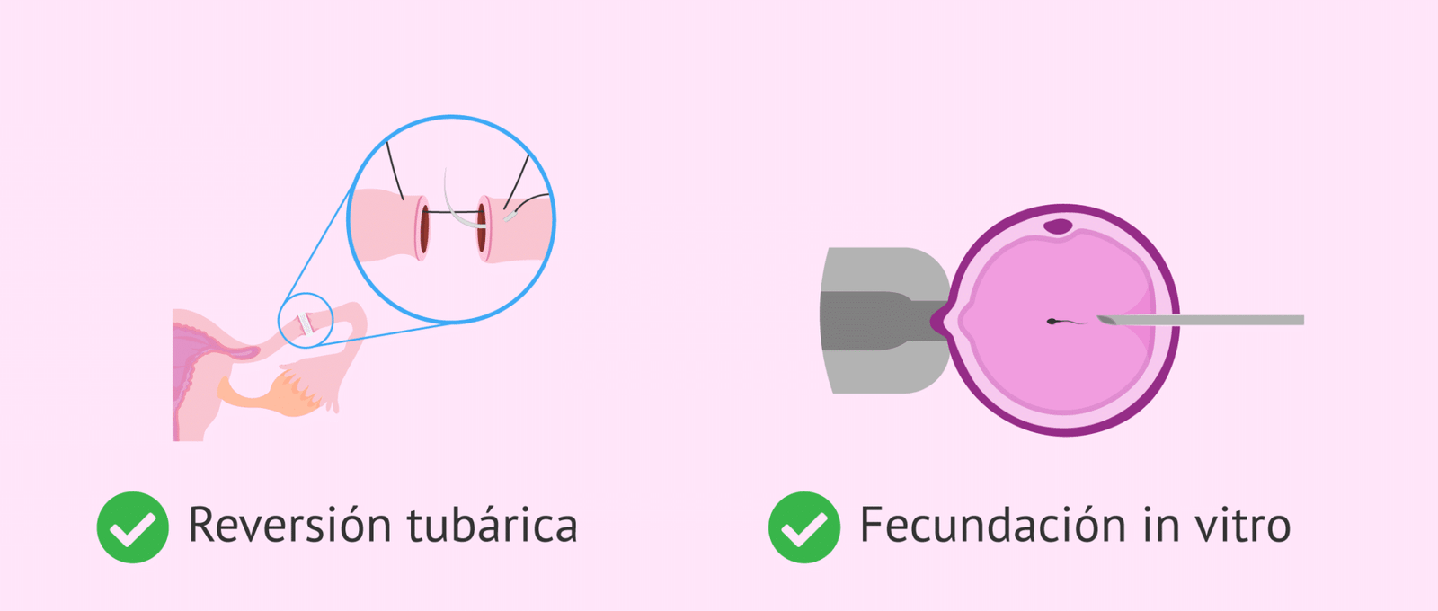 Como Quedar Embarazada Naturalmente Estando Operada
