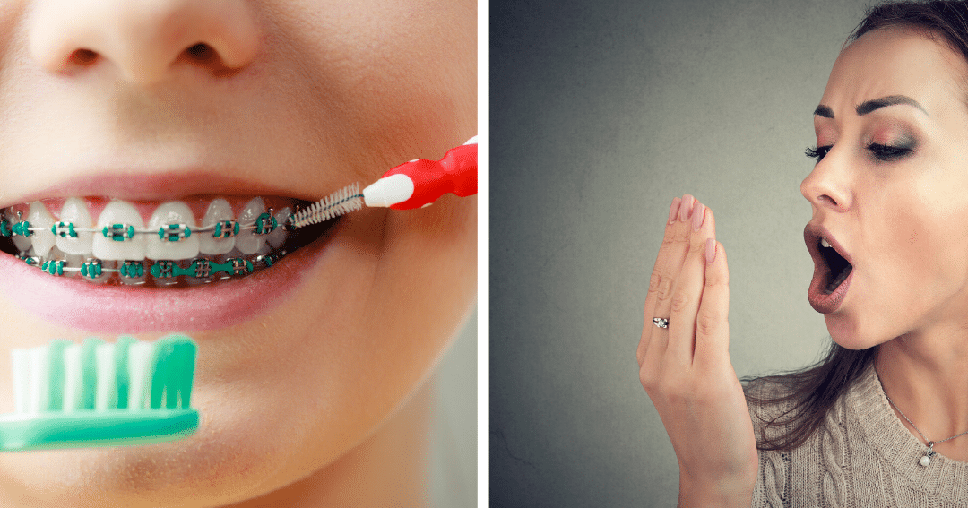 Como Tener Buen Aliento con Brackets