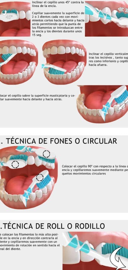 Guía Paso a Paso: Cómo Tirar un Diente de Forma Segura en Casa